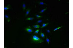 Immunofluorescent analysis of Hela cells using ABIN7151144 at dilution of 1:100 and Alexa Fluor 488-congugated AffiniPure Goat Anti-Rabbit IgG(H+L) (RNF133 抗体  (AA 65-167))
