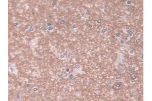 DAB staining on IHC-P; Samples: Human Cerebrum Tissue (SEMG1 抗体  (AA 24-462))