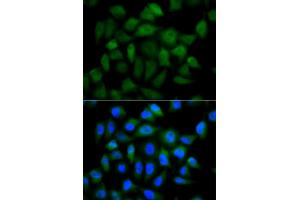 Immunofluorescence analysis of HeLa cells using AFP antibody (ABIN5970034). (alpha Fetoprotein 抗体  (C-Term))