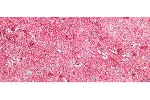 Immunohistochemistry (IHC) image for anti-Glial Fibrillary Acidic Protein (GFAP) (AA 253-354) antibody (ABIN7430747)