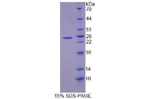 Image no. 1 for Transient Receptor Potential Cation Channel, Subfamily C, Member 6 (TRPC6) (AA 1-192) protein (His tag) (ABIN4990474)
