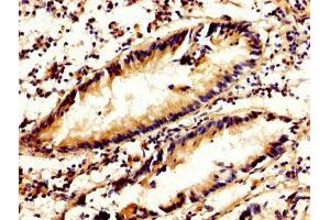 Immunohistochemistry (IHC) image for anti-Calpain 2 (CAPN2) (AA 20-700), (Catalytic Subunit) antibody (ABIN7146540)