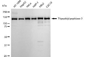 Western blotting analysis using Tripeptidyl peptidase 2 antibody (ABIN7800646). (Recombinant Tpp2 抗体)