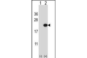 Western blot analysis of EDN2 (arrow) using rabbit polyclonal EDN2 Antibody (C-term) (ABIN657784 and ABIN2846758). (Endothelin 2 抗体  (C-Term))