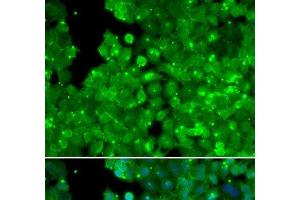Immunofluorescence analysis of U2OS cells using IL10RA Polyclonal Antibody (IL-10RA 抗体)