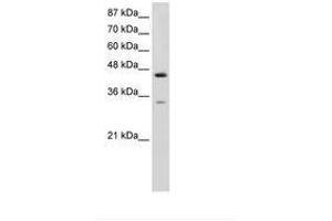 Image no. 1 for anti-Splicing Factor 3b, Subunit 4, 49kDa (SF3B4) (AA 151-200) antibody (ABIN6736239) (SF3B4 抗体  (AA 151-200))