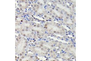 Immunohistochemistry of paraffin-embedded mouse kidney using Phospho-JNK1/2/3-T183/T183/T221 antibody (ABIN6135251, ABIN6135990, ABIN6135991 and ABIN7101879) at dilution of 1:100 (40x lens). (MAPK8/9/10 抗体  (pThr183, pThr221, Thr183))
