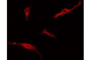 ABIN6274765 staining HeLa cells by IF/ICC. (RPL10A 抗体  (C-Term))