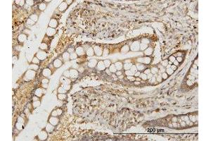 Image no. 1 for anti-N-Myc (And STAT) Interactor (NMI) (AA 1-101) antibody (ABIN598596) (NMI 抗体  (AA 1-101))