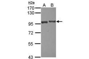 Image no. 1 for anti-USP6 N-terminal Like (USP6NL) (N-Term) antibody (ABIN1494111) (USP6NL 抗体  (N-Term))