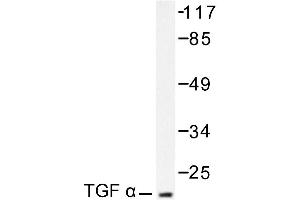 Image no. 1 for anti-Transforming Growth Factor, alpha (TGFA) antibody (ABIN271847) (TGFA 抗体)