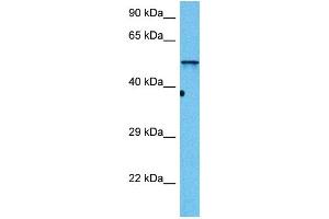 Western Blotting (WB) image for anti-Desmin (DES) (N-Term) antibody (ABIN2776842)