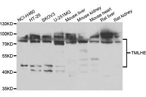 Western blot analysis of extracts of various cell lines, using TMLHE antibody. (TMLHE 抗体)