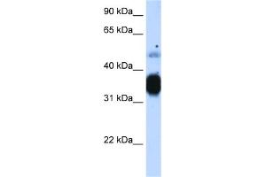 WB Suggested Anti-TNNT3 Antibody Titration:  1. (TNNT3 抗体  (N-Term))