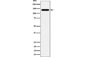 Western blot analysis of CYFIP1 expression in HeLa cell lysate. (Recombinant CYFIP1 抗体)