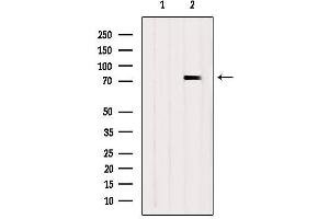 Western blot analysis of extracts from Hela, using SYK Antibody. (SYK 抗体)