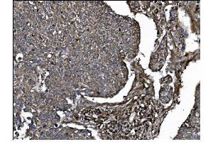 IHC analysis of CD39/ENTPD1 using anti-CD39/ENTPD1 antibody (ABIN7602461).