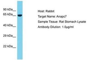ANAPC7 antibody  (AA 387-436)