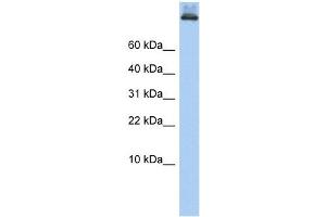 COPA antibody used at 1 ug/ml to detect target protein. (COPA 抗体  (Middle Region))