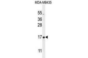CU002 Antibody (C-term) western blot analysis in MDA-MB435 cell line lysates (35µg/lane). (C21orf2 抗体  (C-Term))