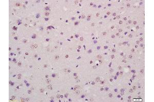 Formalin-fixed and paraffin embedded mouse brain labeled with Rabbit Anti-P73 protein Polyclonal Antibody, Unconjugated  at 1:200 followed by conjugation to the secondary antibody and DAB staining (Tumor Protein p73 抗体  (AA 501-631))