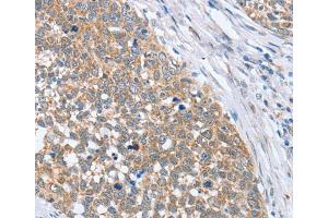 Immunohistochemistry (IHC) image for anti-3'-phosphoadenosine 5'-phosphosulfate Synthase 1 (PAPSS1) antibody (ABIN2422763) (PAPSS1 抗体)