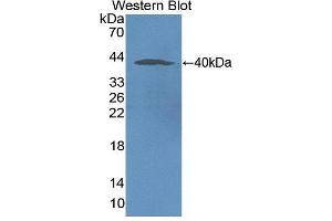 Western blot analysis of the recombinant protein. (NOX5 抗体  (AA 456-765))