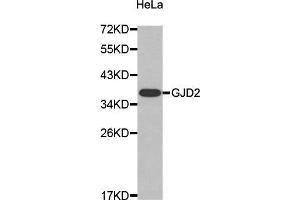Western Blotting (WB) image for anti-Gap Junction Protein, delta 2, 36kDa (GJD2) (AA 99-197) antibody (ABIN3016909) (GJD2 抗体  (AA 99-197))