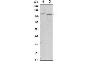 Western blot analysis using FAK mouse mAb against A549 (1) and NIH/3T3 (2) cell lysate. (FAK 抗体)