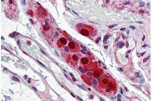 Human Small Intestine, Submucosal Plexus: Formalin-Fixed, Paraffin-Embedded (FFPE)
