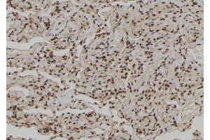 ABIN6272261 at 1/100 staining Human lung tissue by IHC-P. (CEBPZ 抗体  (N-Term))