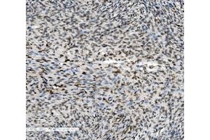 IHC analysis of METTL1 using anti-METTL1 antibody (ABIN7600484). (METTL1 抗体  (AA 2-276))