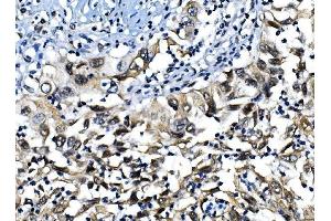 IHC analysis of IRF1 using anti-IRF1 antibody (ABIN7600281).