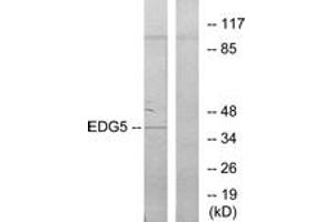 Western blot analysis of extracts from COLO205 cells, using EDG5 Antibody. (S1PR2 抗体  (AA 261-310))