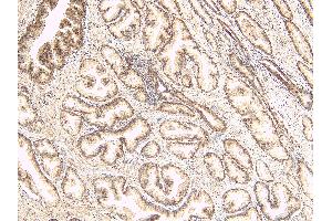 ABIN334520 (8µg/ml) staining of paraffin embedded Human Prostate. (TUSC3 抗体  (Internal Region))