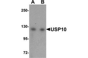 Western blot analysis of USP10 in Jurkat cell lysate with USP10 antibody at (A) 1 and (B) 2 μg/ml. (USP10 抗体  (N-Term))