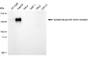 Western blotting analysis using Epidermal growth factor receptor antibody (ABIN7798477). (EGFR 抗体)