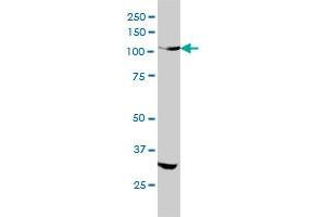 Western Blotting (WB) image for anti-Insulin Receptor-Related Receptor (INSRR) (AA 651-760) antibody (ABIN561505)