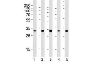 Western blot analysis of lysate from 1) 293, 2) HeLa, 3) mouse NIH3T3, 4) rat PC-12 and 5) rat brain tissue using RPS6 antibody at 1:2000. (RPS6 抗体)