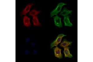 ABIN6264149 and ABIN6273012 staining Hela cells by IF/ICC.