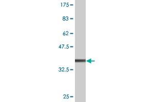 Western Blot detection against Immunogen (37. (TAP1 抗体  (AA 241-350))