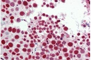 Immunohistochemistry (IHC) image for anti-Zinc Finger, C3HC-Type Containing 1 (ZC3HC1) (AA 320-369) antibody (ABIN2879365)