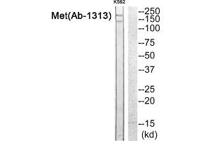 Western blot analysis of extracts from K562 cells, using Met (epitope around residue 1313) antibody. (c-MET 抗体)