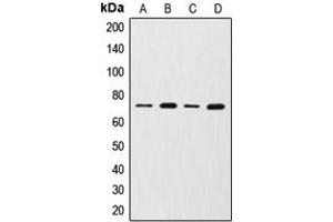 Western blot analysis of MMP2 expression in HuvEc (A), NRK (B), MCF7 (C), HT1080 (D) whole cell lysates. (MMP2 抗体  (C-Term))