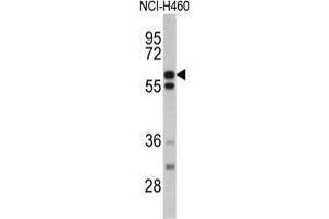 Western blot analysis of GNS antibody (Center S298) in NCI-H460 cell line lysates (35 µg/lane). (GNS 抗体  (Middle Region))