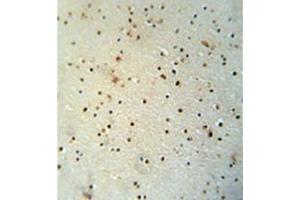Immunohistochemistry analysis in formalin fixed and paraffin embedded human brain tissue reacted with MED25 Antibody (N-term) followed which was peroxidase conjugated to the secondary antibody and followed by DAB staining.