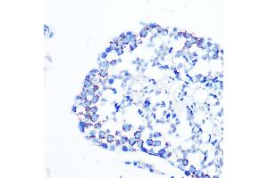 Immunohistochemistry of paraffin-embedded mouse testis using Monoamine Oxidase B (MAOB) (MAOB) Rabbit mAb (ABIN7268682) at dilution of 1:100 (40x lens). (Monoamine Oxidase B 抗体)