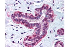 Anti-WRNIP1 / WHIP antibody IHC of human breast. (WRNIP1 抗体  (AA 67-116))