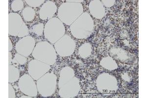Immunoperoxidase of monoclonal antibody to MPG on formalin-fixed paraffin-embedded human lymph node. (MPG 抗体  (AA 1-90))