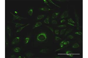 Immunofluorescence of purified MaxPab antibody to GSTK1 on HeLa cell. (GSTK1 抗体  (AA 1-226))